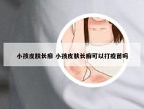 小孩皮肤长癣 小孩皮肤长癣可以打疫苗吗