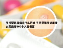 寻常型银屑病吃什么药好 寻常型银屑病用什么药最好360个人图书馆