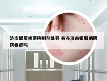 济南银屑病医院制剂处罚 有在济南银屑病医院看病吗