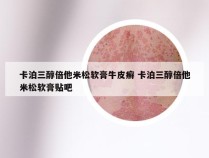 卡泊三醇倍他米松软膏牛皮癣 卡泊三醇倍他米松软膏贴吧