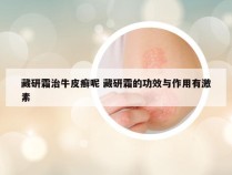 藏研霜治牛皮癣呢 藏研霜的功效与作用有激素
