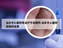 汕头中心医院有治疗牛皮癣吗 汕头中心医院皮肤科收费