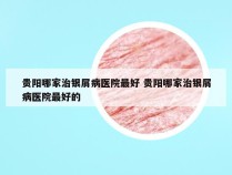 贵阳哪家治银屑病医院最好 贵阳哪家治银屑病医院最好的