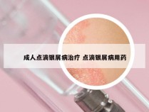 成人点滴银屑病治疗 点滴银屑病用药