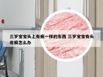 三岁宝宝头上有癣一样的东西 三岁宝宝有头皮癣怎么办