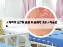 大蒜有效治疗银屑病 银屑病可以用大蒜杀菌吗