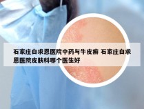 石家庄白求恩医院中药与牛皮癣 石家庄白求恩医院皮肤科哪个医生好