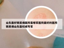 山东最好银屑病医院是哪家医院最好的医院 银屑病山东最权威专家