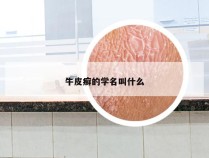 牛皮癣的学名叫什么
