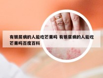 有银屑病的人能吃芒果吗 有银屑病的人能吃芒果吗百度百科