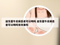 益生菌牛皮癣患者可以喝吗 益生菌牛皮癣患者可以喝吗有效果吗