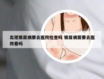 出现银屑病要去医院检查吗 银屑病需要去医院看吗