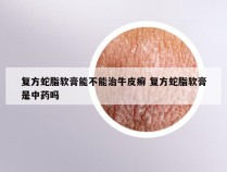 复方蛇脂软膏能不能治牛皮癣 复方蛇脂软膏是中药吗