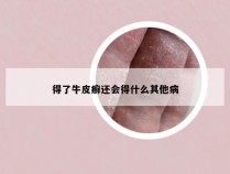 得了牛皮癣还会得什么其他病