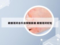 戴银耳环会不会得银屑病 戴银耳环好处