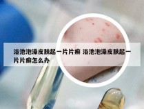 浴池泡澡皮肤起一片片癣 浴池泡澡皮肤起一片片癣怎么办