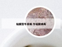 粘膜型牛皮癣 牛粘膜病毒