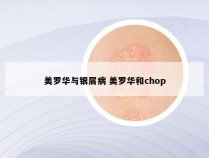 美罗华与银屑病 美罗华和chop