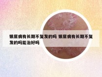 银屑病有长期不复发的吗 银屑病有长期不复发的吗能治好吗