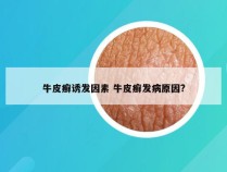 牛皮癣诱发因素 牛皮癣发病原因?