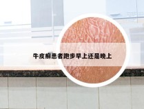 牛皮癣患者跑步早上还是晚上