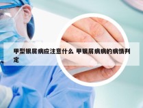 甲型银屑病应注意什么 甲银屑病病的病情判定