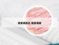 银屑病表达 银屑病病