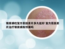 银屑病吃复方氨肽素片多久能好 复方氨肽素片治疗银屑病有效果吗