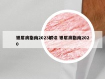 银屑病指南2023解读 银屑病指南2020