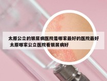 太原公立的银屑病医院是哪家最好的医院最好 太原哪家公立医院看银屑病好