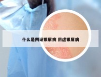 什么是阴证银屑病 阴虚银屑病