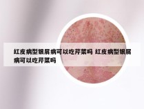 红皮病型银屑病可以吃芹菜吗 红皮病型银屑病可以吃芹菜吗