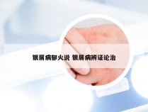 银屑病郁火说 银屑病辨证论治