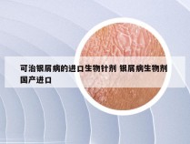 可治银屑病的进口生物针剂 银屑病生物剂 国产进口
