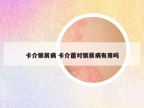 卡介银屑病 卡介菌对银屑病有用吗