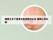 胳膊上长了很多红色得藓怎么办 胳膊上长红癣