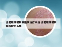合肥银康银屑病医院治疗手段 合肥银康银屑病医院怎么样