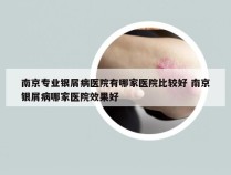 南京专业银屑病医院有哪家医院比较好 南京银屑病哪家医院效果好