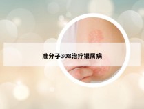 准分子308治疗银屑病