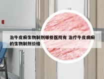 治牛皮癣生物制剂哪些医院有 治疗牛皮病癣的生物制剂价格