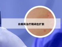 白癜风治疗期间在扩散