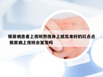 银屑病患者上夜班熬夜身上就出来好的红点点 银屑病上夜班会复发吗