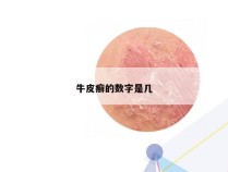 牛皮癣的数字是几