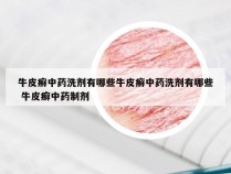 牛皮癣中药洗剂有哪些牛皮癣中药洗剂有哪些 牛皮癣中药制剂