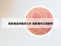银屑病坚持跑步三年 银屑病可以慢跑吗