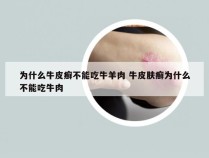 为什么牛皮癣不能吃牛羊肉 牛皮肤癣为什么不能吃牛肉