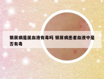 银屑病是属血液有毒吗 银屑病患者血液中是否有毒