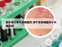 南宁有几家牛皮癣医院 南宁皮肤病医院十大排名榜