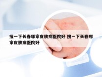 搜一下长春哪家皮肤病医院好 搜一下长春哪家皮肤病医院好