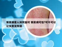 银屑病爱人如何面对 银屑病可怕?可不可以让女朋友知道